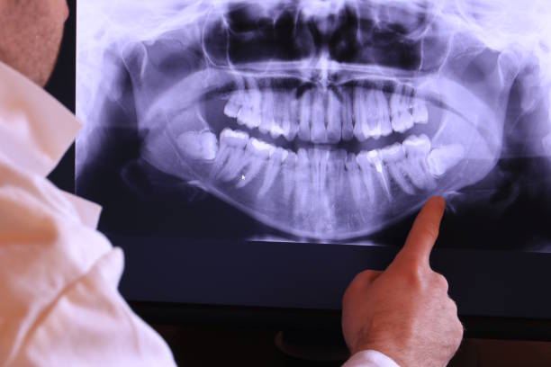 Best Emergency Dental Care for Abscessed Tooth in Maury, NC